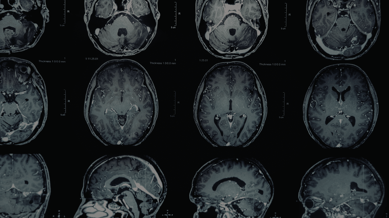 Brain scans in rows